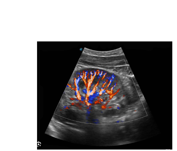 Ultrasound / Doppler